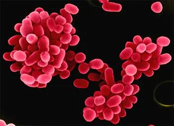 Imagem da bactéria do gênero Brucella