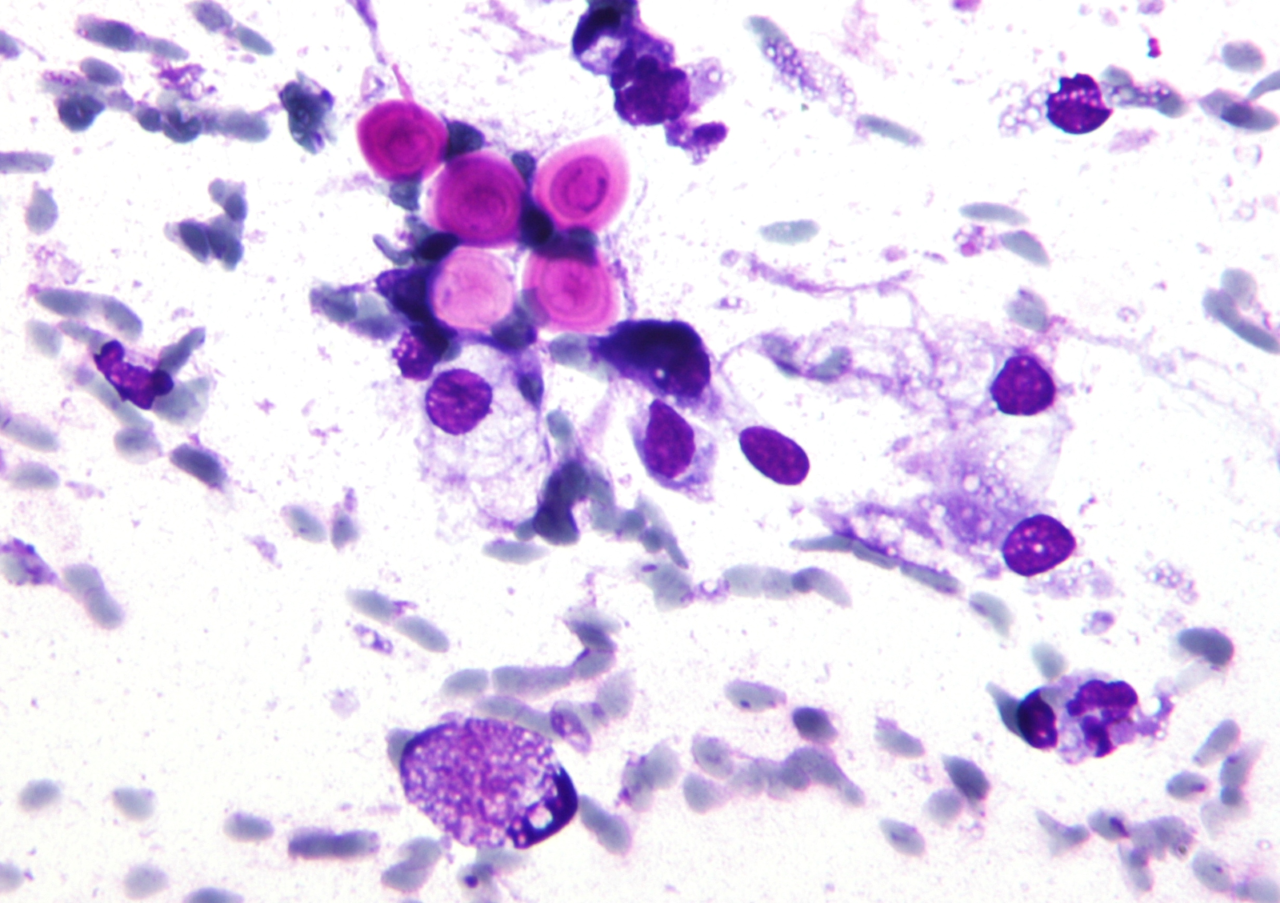 Imagem do fungo Cryptococcus neoformans